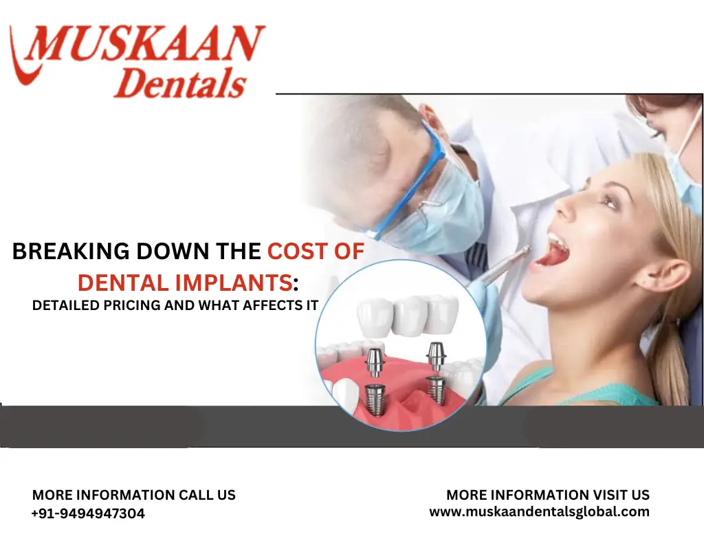 Breaking Down the Cost of Dental Implants Detailed Pricing and What Affects It