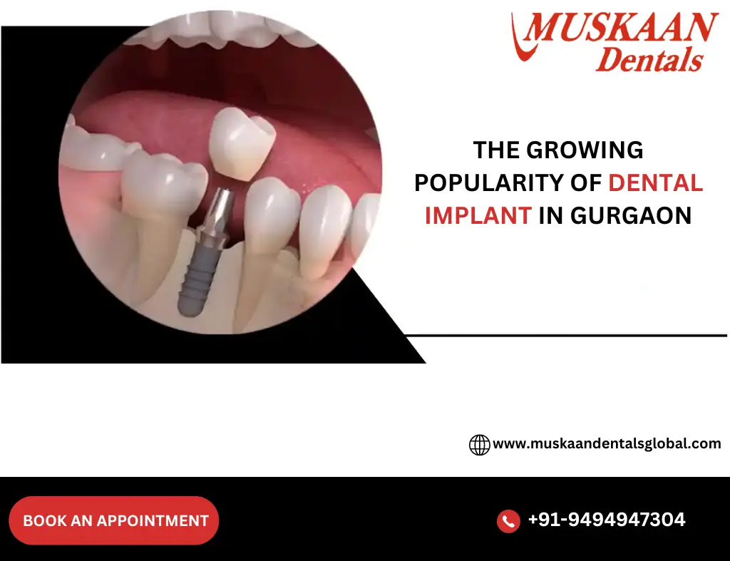 The Growing Popularity of Dental Implant in Gurgaon