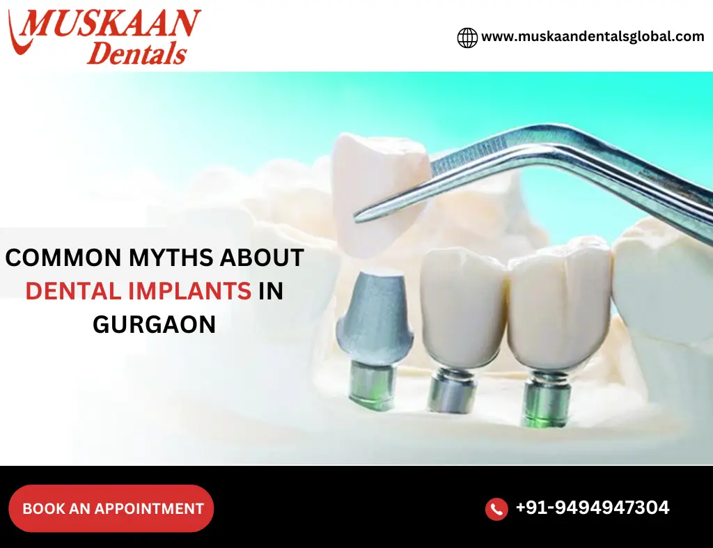 Common Myths About Dental Implants in Gurgaon