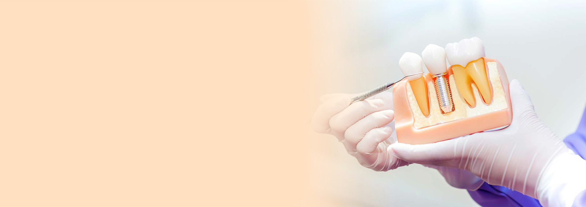 Best Dental Clinic In Gurgaon Largest Dental Chain In Delhi NCR